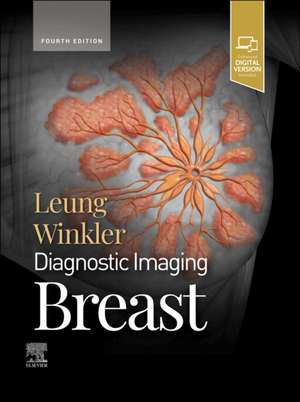 Diagnostic Imaging: Breast de Jessica Leung