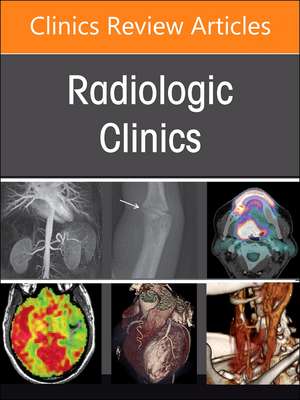 Pulmonary Vascular Disease, An Issue of Radiologic Clinics of North America de Jeffrey P Kanne