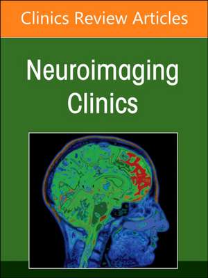 Imaging of Neurofluids, An Issue of Neuroimaging Clinics of North America de Nivedita Agarwal