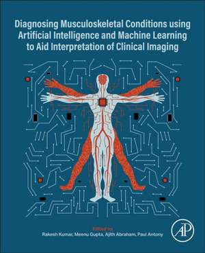 Diagnosing Musculoskeletal Conditions using Artifical Intelligence and Machine Learning to Aid Interpretation of Clinical Imaging de Rakesh Kumar