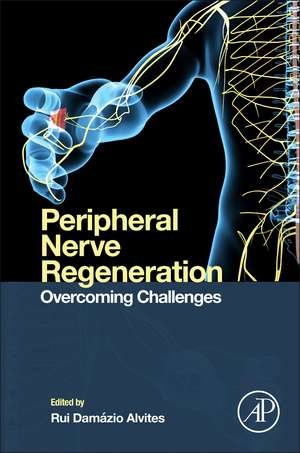 Peripheral Nerve Regeneration: Overcoming Challenges de Rui Damázio Alvites