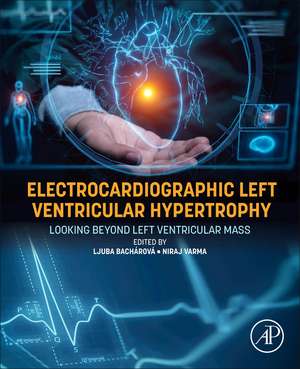 Electrocardiographic Left Ventricular Hypertrophy: Looking Beyond Left Ventricular Mass de Ljuba Bachárová