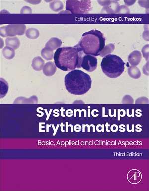 Systemic Lupus Erythematosus: Basic, Applied and Clinical Aspects de George C. Tsokos