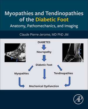 Myopathies and Tendinopathies of the Diabetic Foot: Anatomy, Pathomechanics, and Imaging de Claude Pierre-Jerome