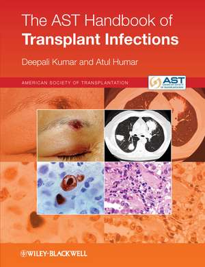 The AST Handbook of Transplant Infections de D Kumar