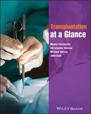 Transplantation at a Glance de Menna Clatworthy