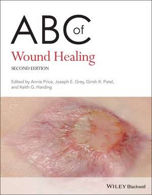 ABC of Wound Healing 2nd Edition de A Price