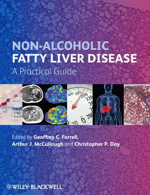 Non–Alcoholic Fatty Liver Disease – A Practical Guide de G. Farrell