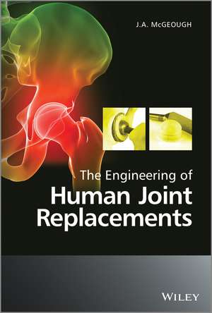 The Engineering of Human Joint Replacements de J. A. McGeough