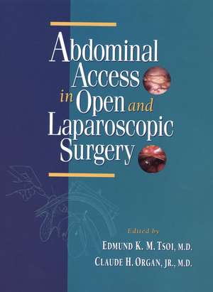 Abdominal Access in Open and Laparoscopic Surgery de EKM Tsoi