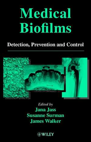 Medical Biofilms – Detection, Prevention and Control V 2 de J Jass