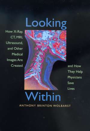 Looking Within – How X–Ray, CT, MRI, Ultrasound, & Other Medical Images are Created & How they Help Physicians Save Lives (Paper) de Anthony Brinton Wolbarst