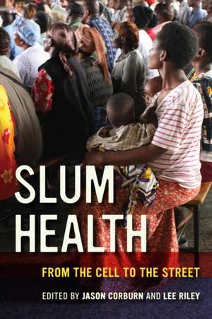 Slum Health – From the Cell to the Street de Jason Corburn