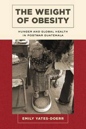 The Weight of Obesity – Hunger and Global Health in Postwar Guatemala de Emily Yates–doerr