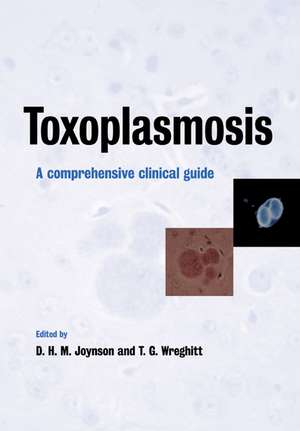 Toxoplasmosis: A Comprehensive Clinical Guide de David H. M. Joynson