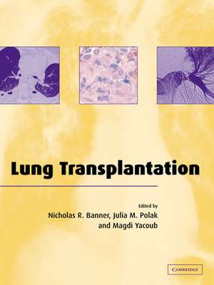 Lung Transplantation de Nicholas R. Banner