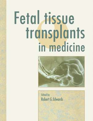 Fetal Tissue Transplants in Medicine de Robert G. Edwards