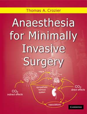 Anaesthesia for Minimally Invasive Surgery de Thomas Allen Crozier