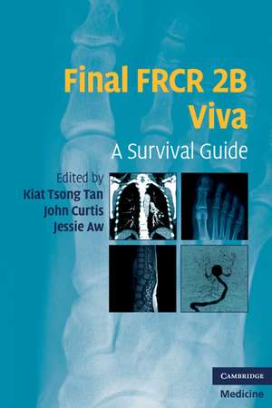 Final FRCR 2B Viva: A Survival Guide de Kiat Tsong Tan