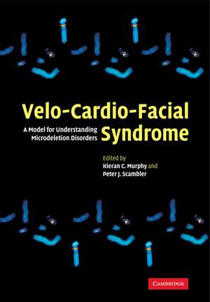 Velo-Cardio-Facial Syndrome: A Model for Understanding Microdeletion Disorders de Kieran C. Murphy