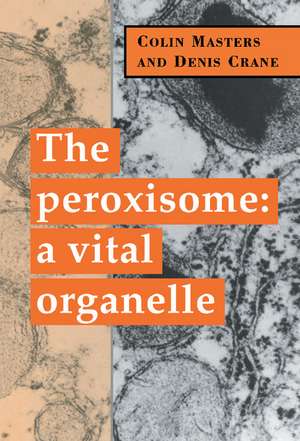 The Peroxisome: A Vital Organelle de Colin Masters