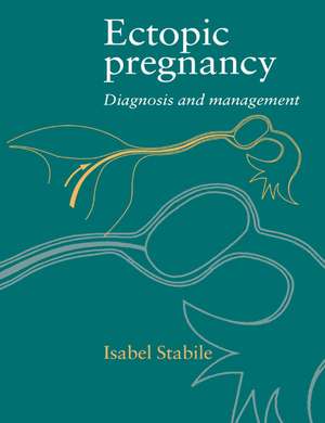 Ectopic Pregnancy: Diagnosis and Management de Isabel Stabile