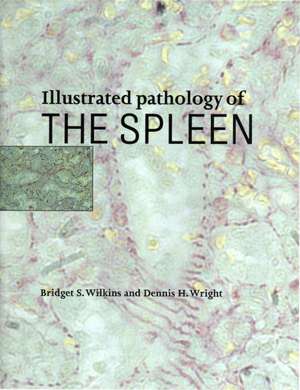 Illustrated Pathology of the Spleen de Bridget S. Wilkins