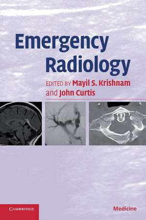 Emergency Radiology de Mayil S. Krishnam