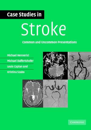 Case Studies in Stroke: Common and Uncommon Presentations de Michael G. Hennerici