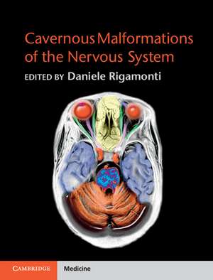 Cavernous Malformations of the Nervous System de Daniele Rigamonti MD