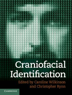 Craniofacial Identification de Caroline Wilkinson