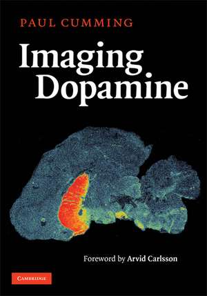 Imaging Dopamine de Paul Cumming