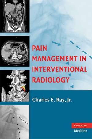 Pain Management in Interventional Radiology de Charles E. Ray, Jr.