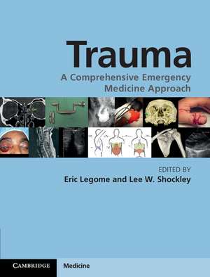 Trauma: A Comprehensive Emergency Medicine Approach de Eric Legome