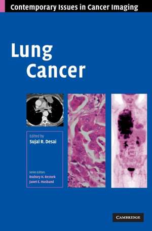 Lung Cancer de Sujal R. Desai