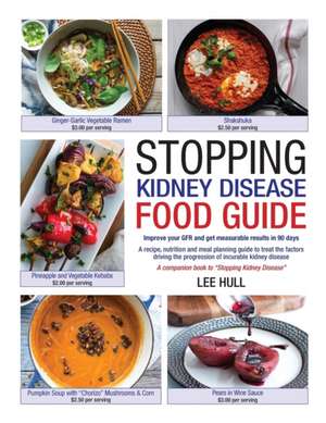 Stopping Kidney Disease Food Guide de Lee Hull