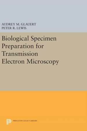 Biological Specimen Preparation for Transmission Electron Microscopy de Audrey M. Glauert