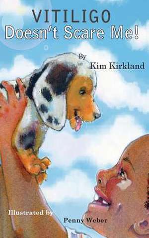 Vitiligo Doesn't Scare Me de Kim Kirkland