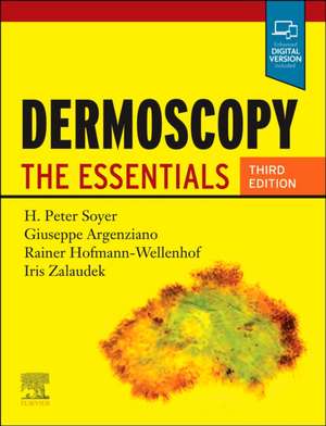 Dermoscopy: The Essentials de H. Peter Soyer