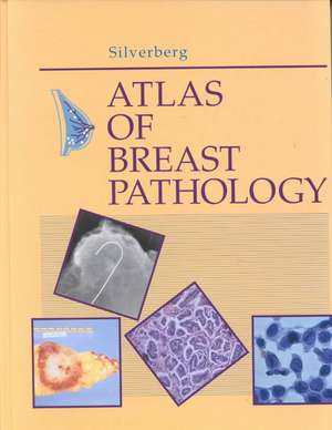 Atlas of Breast Pathology de Steven G. Silverberg