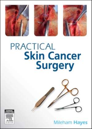 Practical Skin Cancer Surgery de Mileham Hayes