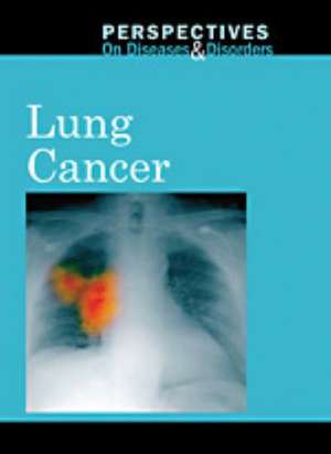 Lung Cancer de Jacqueline Langwith