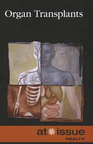 Organ Transplants de Diane Andrews Henningfeld