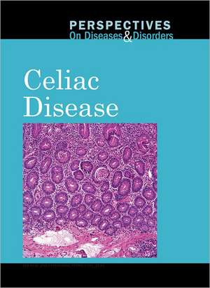 Celiac Disease de Jacqueline Langwith