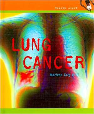 Lung Cancer de Marlene Targ Brill