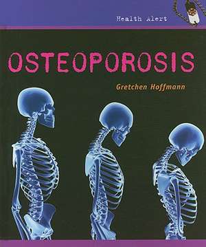 Osteoporosis de Gretchen Hoffman