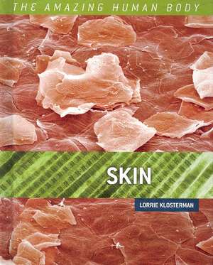 Skin de Lorrie Klosterman