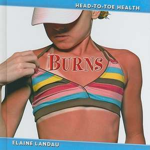 Burns de Elaine Landau