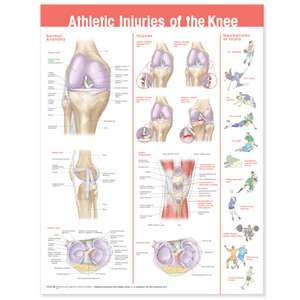 Athletic Injuries of the Knee Anatomical Chart de Anatomical Chart Company