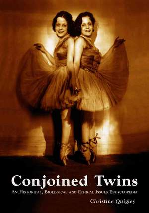 Conjoined Twins: A Historical, Biological And Ethical Issues Encyclopedia de Christine Quigley